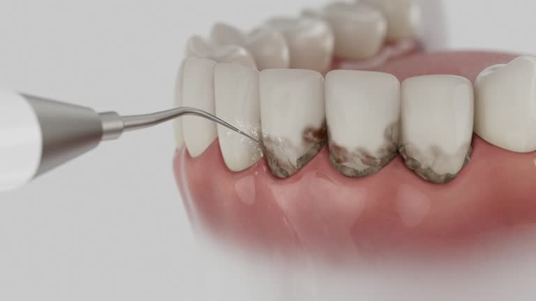 Trusted Wisdom Tooth Removal service in Ester, AK - Dentist Open Now